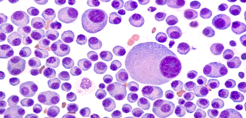 BCMA-Directed Therapies: Improving Outcomes of Patients with Relapsed/Refractory Multiple Myeloma