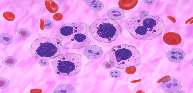 Relapsed or Refractory Multiple Myeloma: Integrating Recent Advances Into Your Practice