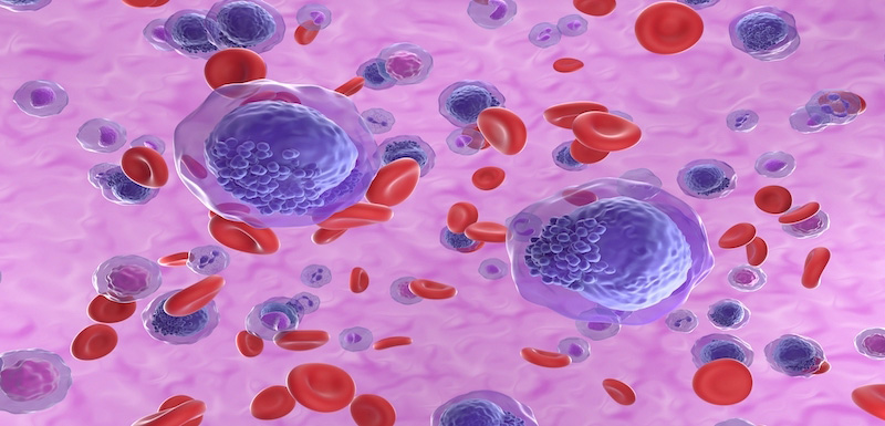 A Moving Target: Exploring the Use of Maintenance Therapy for Acute Myeloid Leukemia