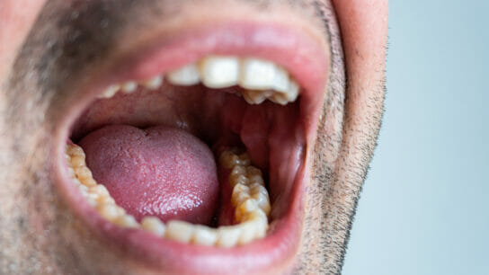 man with mouth open