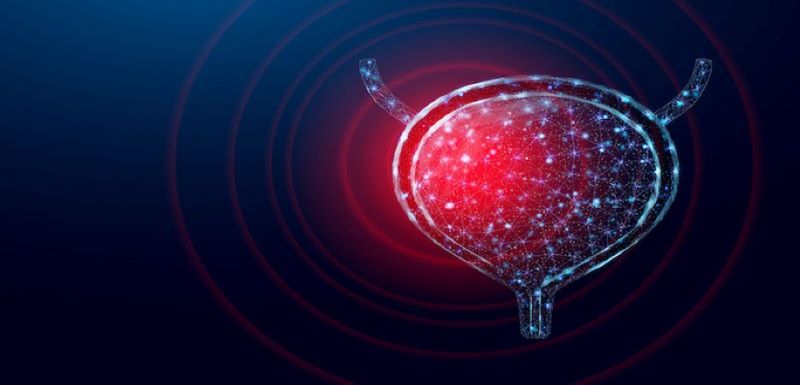 Improving Bladder Cancer Survival by Integrating New Knowledge into Clinical Practice