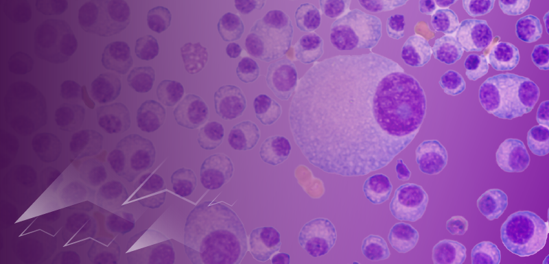 Oncology Town Hall™: Primary Investigators Present Key Abstracts in Multiple Myeloma from the Summer Meetings